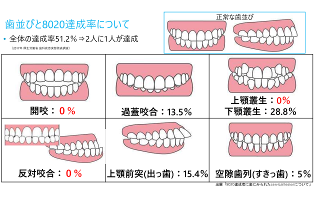 歯並びと残存歯数の関係
